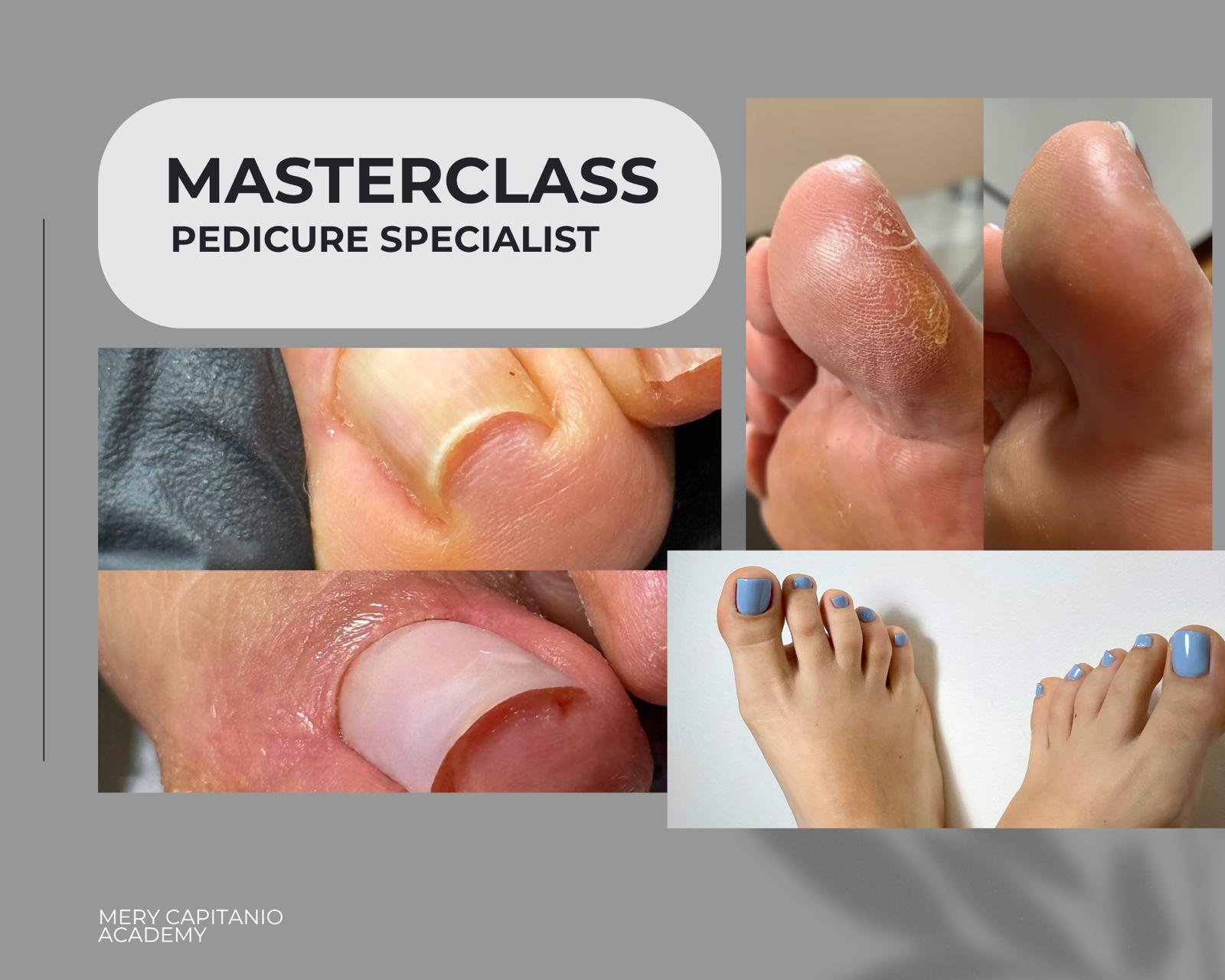 Pedicure Specialist